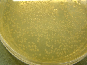 Bacteria on an agar plate after succesfull plasmid transformation